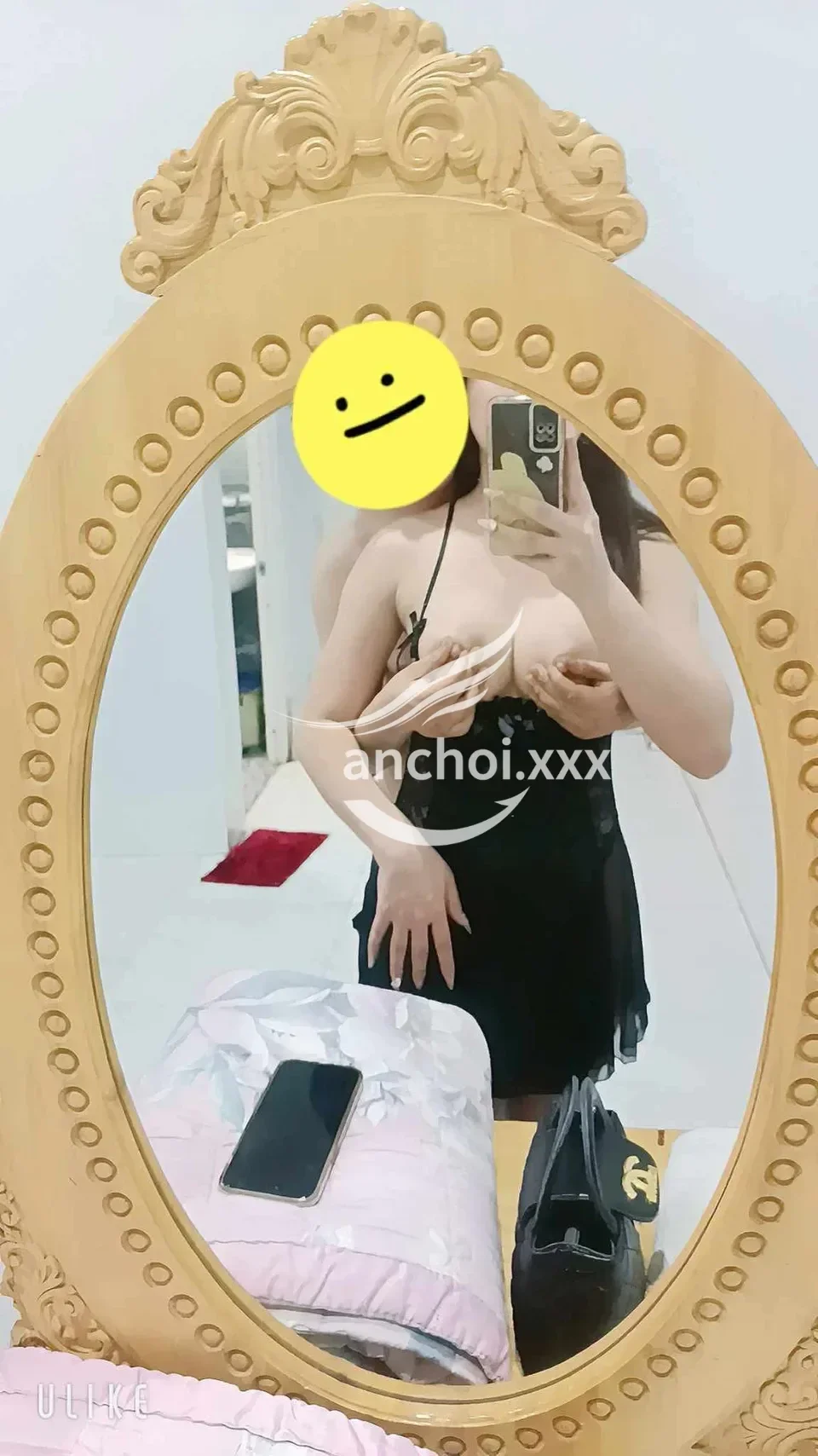 ảnh report